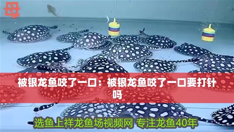 被銀龍魚咬了一口：被銀龍魚咬了一口要打針嗎