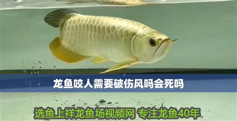 龍魚咬人需要破傷風(fēng)嗎會(huì)死嗎