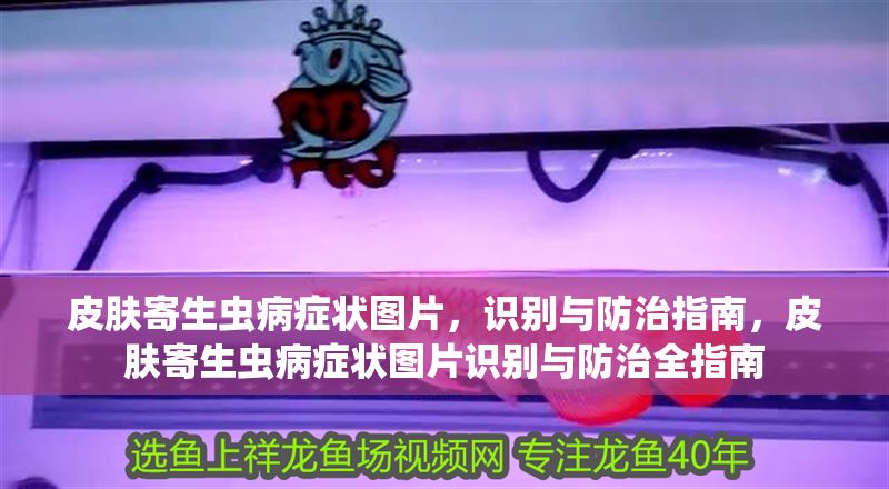 皮膚寄生蟲病癥狀圖片，識別與防治指南，皮膚寄生蟲病癥狀圖片識別與防治全指南