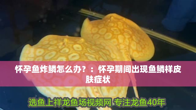 懷孕魚炸鱗怎么辦？：懷孕期間出現(xiàn)魚鱗樣皮膚癥狀 懷孕魚炸鱗怎么辦？：懷孕期間出現(xiàn)魚鱗樣皮膚癥狀 龍魚百科