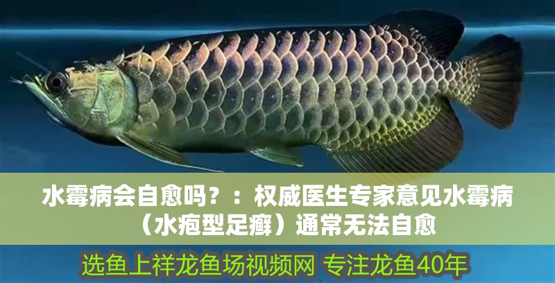 水霉病會(huì)自愈嗎？：權(quán)威醫(yī)生專家意見水霉病（水皰型足癬）通常無(wú)法自愈