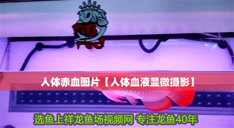 人體赤血圖片【人體血液顯微攝影】 龍魚論壇 人體赤血圖片【人體血液顯微攝影】 人體赤血圖片【人體血液顯微攝影】 龍魚論壇