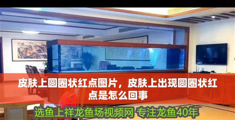 皮膚上圓圈狀紅點圖片，皮膚上出現(xiàn)圓圈狀紅點是怎么回事