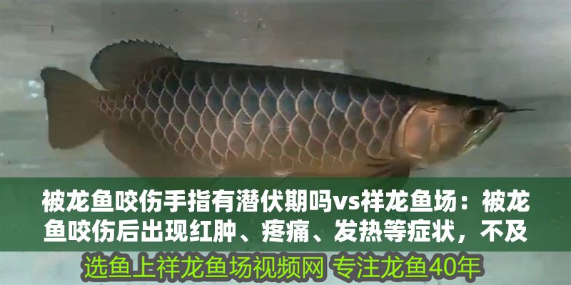 被龍魚咬傷手指有潛伏期嗎vs祥龍魚場：被龍魚咬傷后出現紅腫、疼痛、發熱等癥狀，不及時處理