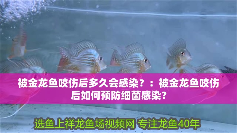 被金龍魚咬傷后多久會感染？：被金龍魚咬傷后如何預防細菌感染？