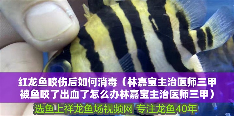 紅龍魚咬傷后如何消毒（林嘉寶主治醫(yī)師三甲被魚咬了出血了怎么辦林嘉寶主治醫(yī)師三甲）