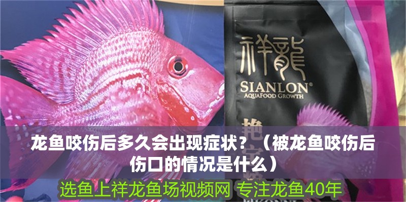 龍魚咬傷后多久會出現癥狀？（被龍魚咬傷后傷口的情況是什么）