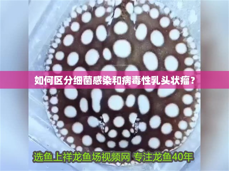 如何區分細菌感染和病毒性乳頭狀瘤？