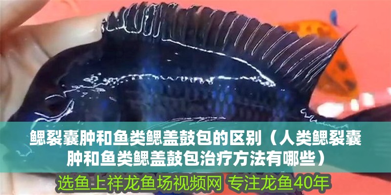 鰓裂囊腫和魚類鰓蓋鼓包的區別（人類鰓裂囊腫和魚類鰓蓋鼓包治療方法有哪些）