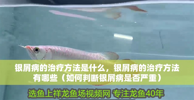 銀屑病的治療方法是什么，銀屑病的治療方法有哪些（如何判斷銀屑病是否嚴重）