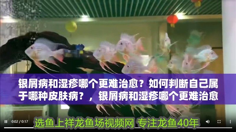 銀屑病和濕疹哪個更難治愈？如何判斷自己屬于哪種皮膚病？，銀屑病和濕疹哪個更難治愈銀屑病和濕疹哪個更常見