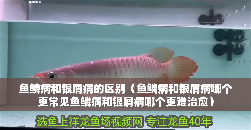 魚鱗病和銀屑病的區別（魚鱗病和銀屑病哪個更常見魚鱗病和銀屑病哪個更難治愈）