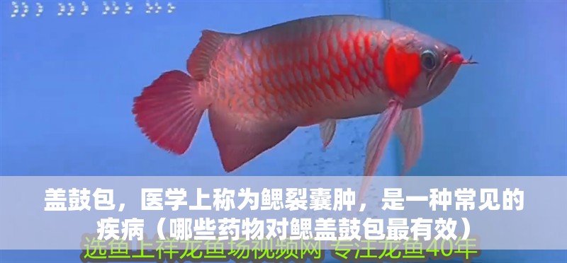 蓋鼓包，醫學上稱為鰓裂囊腫，是一種常見的疾病（哪些藥物對鰓蓋鼓包最有效）