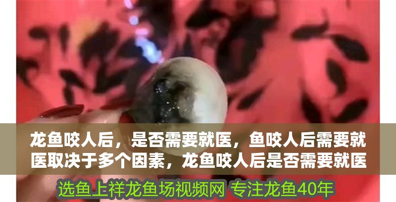 龍魚咬人后，是否需要就醫，魚咬人后需要就醫取決于多個因素，龍魚咬人后是否需要就醫