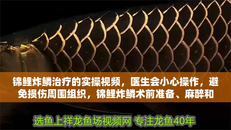 錦鯉炸鱗治療的實操視頻，醫(yī)生會小心操作，避免損傷周圍組織，錦鯉炸鱗術(shù)前準(zhǔn)備、麻醉和手術(shù)步驟