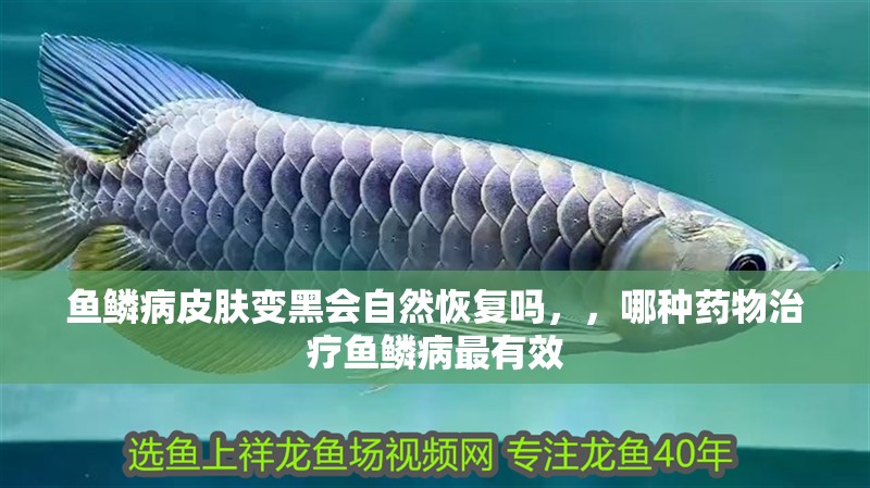 魚鱗病皮膚變黑會自然恢復嗎，，哪種藥物治療魚鱗病最有效