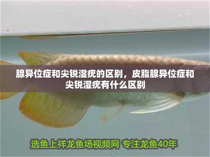 腺異位癥和尖銳濕疣的區(qū)別，皮脂腺異位癥和尖銳濕疣有什么區(qū)別