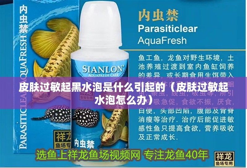 皮膚過敏起<strong><mark>黑水</mark></strong>泡是什么引起的（皮膚過敏起水泡怎么辦）