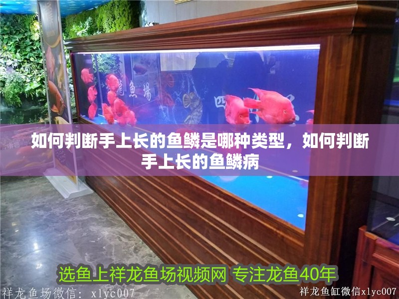 如何判斷手上長(zhǎng)的魚(yú)鱗是哪種類(lèi)型，如何判斷手上長(zhǎng)的魚(yú)鱗病