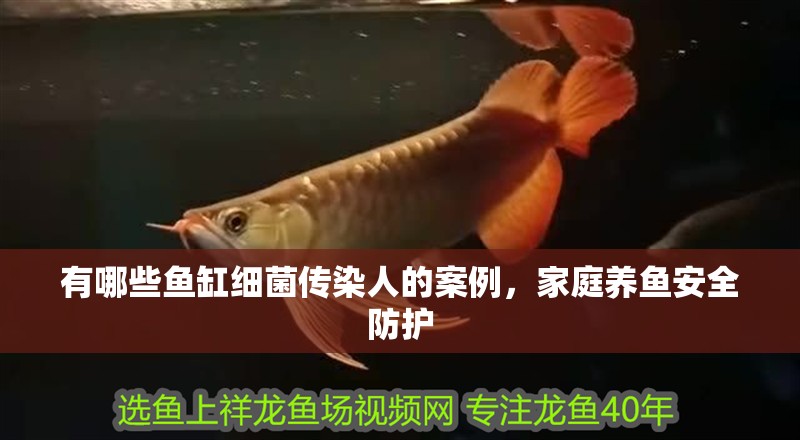有哪些魚缸細菌傳染人的案例，家庭養(yǎng)魚安全防護 有哪些魚缸細菌傳染人的案例，家庭養(yǎng)魚安全防護 龍魚百科
