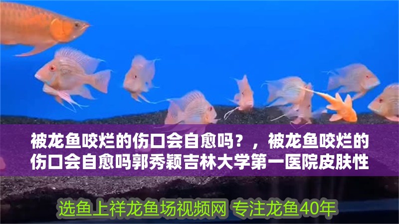 被龍魚咬爛的傷口會自愈嗎？，被龍魚咬爛的傷口會自愈嗎郭秀穎<strong><mark>吉林</mark></strong>大學第一醫院皮膚性病科