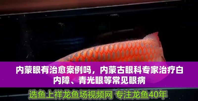 內蒙眼有治愈案例嗎，內蒙古眼科專家治療白內障、青光眼等常見眼病 內蒙眼有治愈案例嗎，內蒙古眼科專家治療白內障、青光眼等常見眼病 龍魚百科