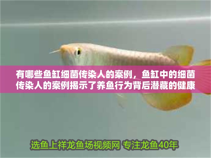 有哪些魚缸細菌傳染人的案例，魚缸中的細菌傳染人的案例揭示了養(yǎng)魚行為背后潛藏的健康風險