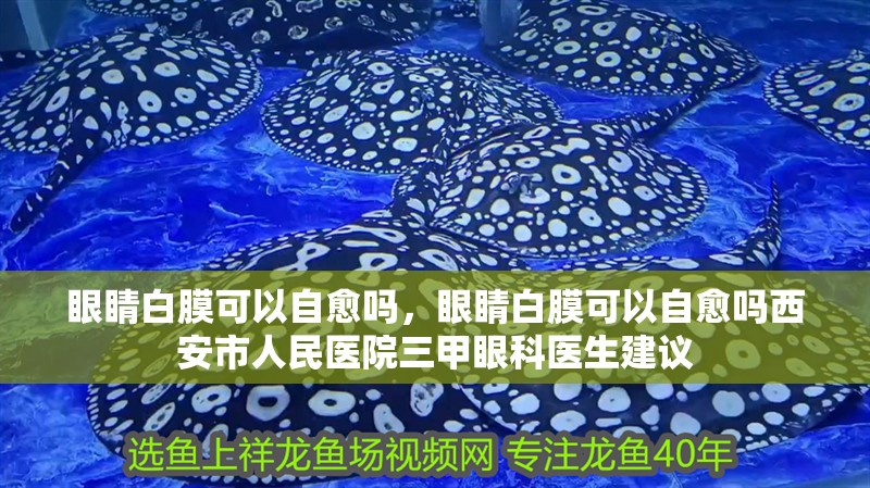 眼睛白膜可以自愈嗎，眼睛白膜可以自愈嗎西安市人民醫院三甲眼科醫生建議