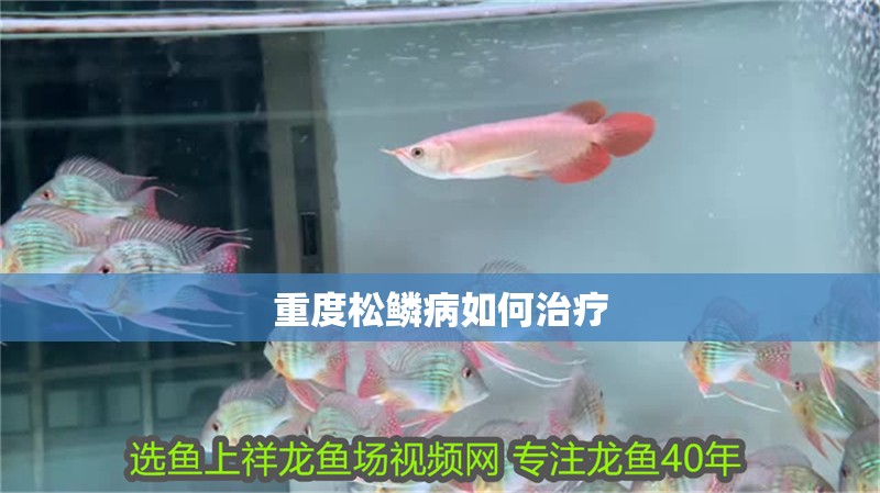 重度松鱗病如何治療