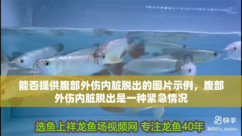能否提供腹部外傷內臟脫出的圖片示例，腹部外傷內臟脫出是一種緊急情況