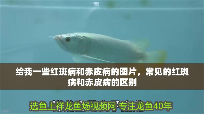 給我一些紅斑病和赤皮病的圖片，常見的紅斑病和赤皮病的區別