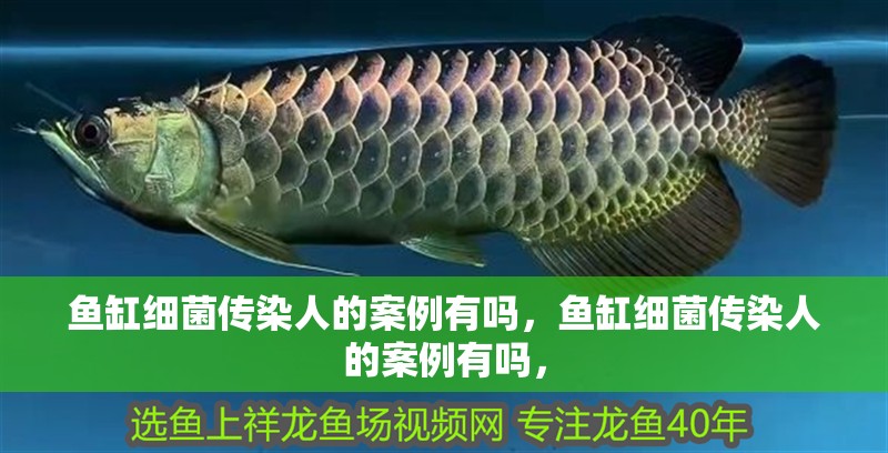 魚缸細(xì)菌傳染人的案例有嗎，魚缸細(xì)菌傳染人的案例有嗎，