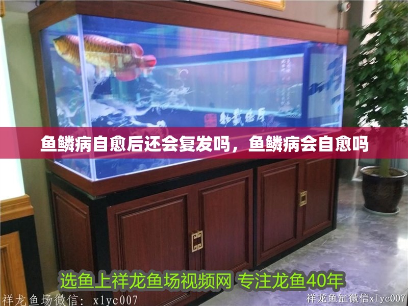 魚鱗病自愈后還會復發嗎，魚鱗病會自愈嗎