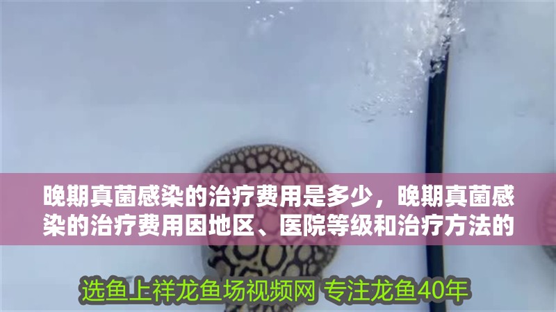 晚期真菌感染的治療費用是多少，晚期真菌感染的治療費用因地區、醫院等級和治療方法的不同而有所差異