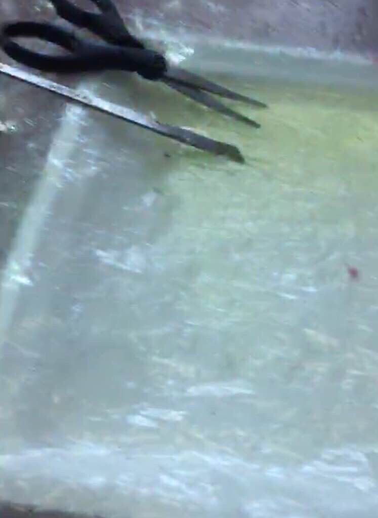 切尾手術