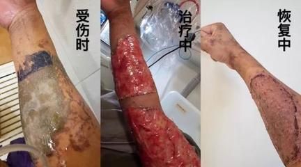 小虎魚身上有白膜正常嗎怎么治：小虎魚身上出現白膜正常嗎怎么治小虎魚身上有白膜正常嗎