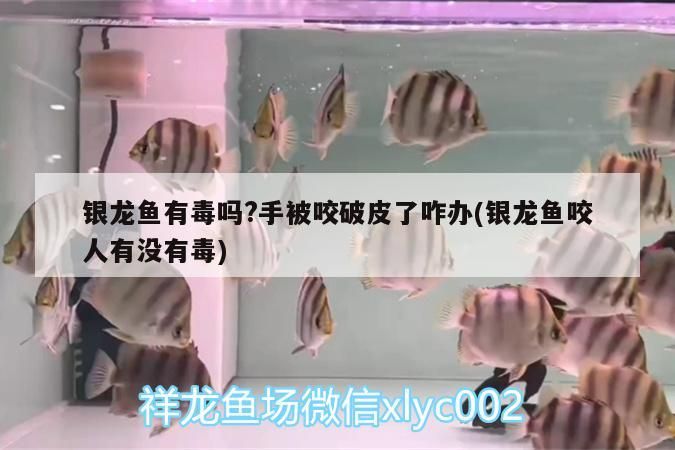 銀龍魚有毒嗎?手被咬破皮了咋辦(銀龍魚咬人有沒有毒) 銀龍魚有毒嗎?手被咬破皮了咋辦(銀龍魚咬人有沒有毒) 銀龍魚百科