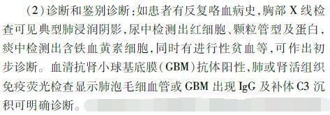 客廳一進門對著魚缸好嗎？風水與設計的全面解析 客廳一進門對著魚缸好嗎？風水與設計的全面解析 龍魚百科 第3張