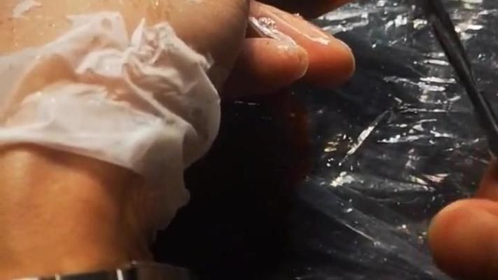 魚鰭受傷能否恢復？