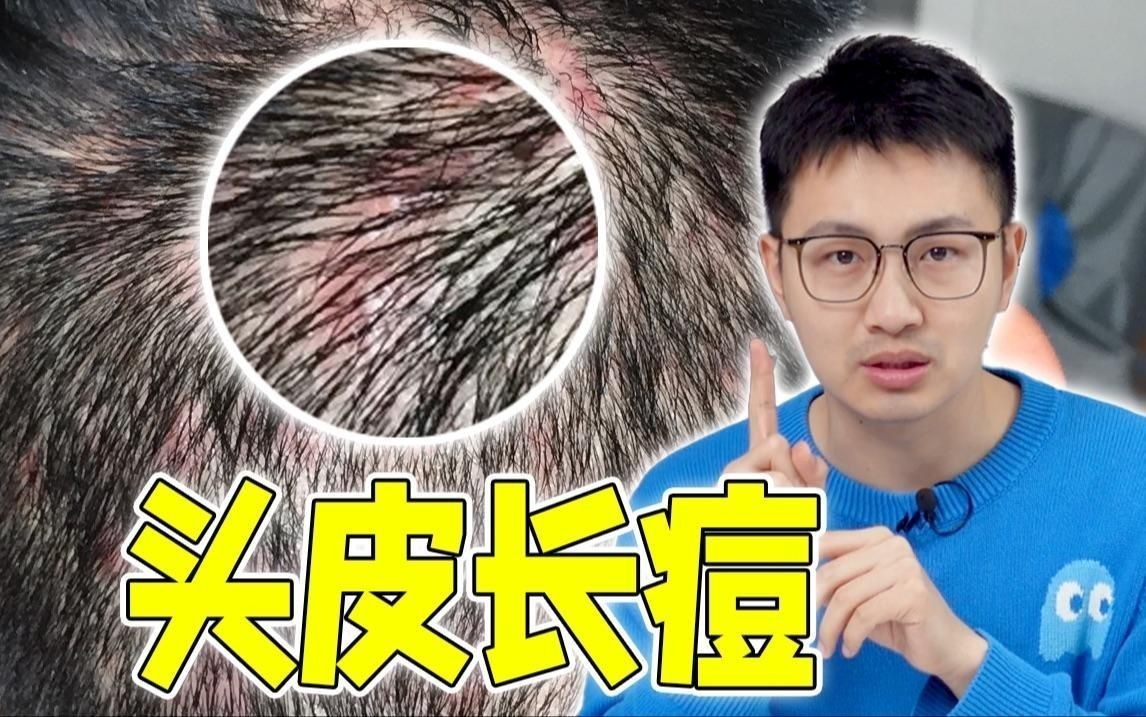 怎么判斷是真菌還是細(xì)菌，幾種不同風(fēng)格的簡短標(biāo)題示例供你參考，，辨真菌與細(xì)菌之法，區(qū)分真菌細(xì)菌妙招，識