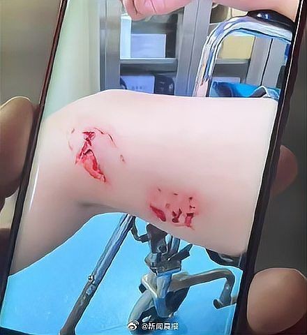 號(hào)半龍魚咬人后圖片 號(hào)半龍魚咬人后圖片 全國水族館企業(yè)名錄 第34張