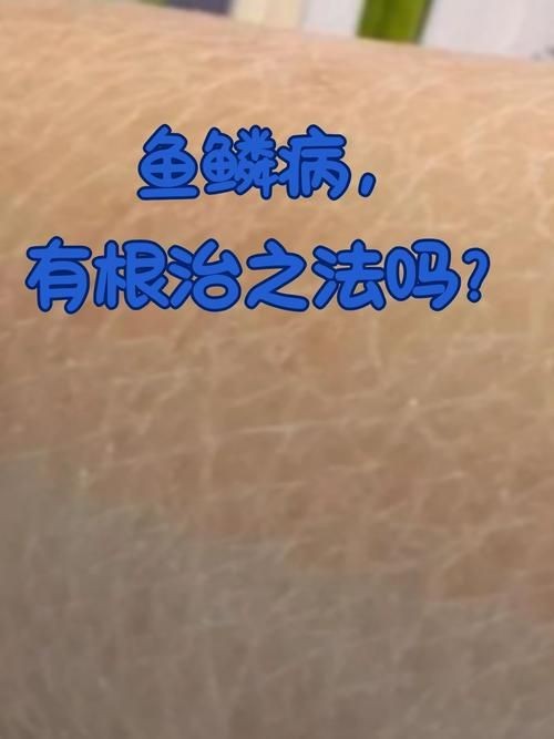 豎鱗病圖片，豎鱗病典型癥狀高清圖片 豎鱗病圖片，豎鱗病典型癥狀高清圖片 龍魚百科 第7張