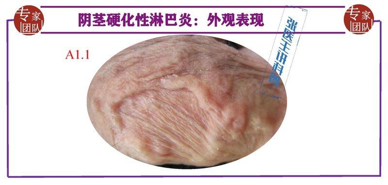 莖上長硬筋的圖片，莖部硬筋特征高清實