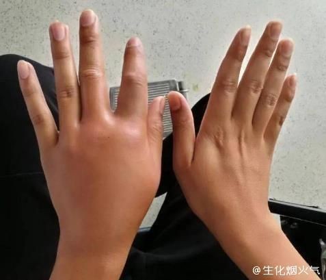 海洋弧菌感染早期圖片 海洋弧菌感染早期圖片 龍魚(yú)百科 第3張