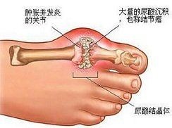 海豹的肉能不能吃：關(guān)于“海豹的肉能否食用”這一問題需從法律、倫理、生態(tài)及健康多維度綜合考量