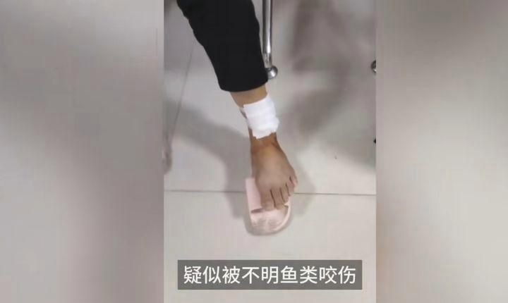 號半龍魚咬人后圖片：“號半龍魚咬人后”圖片引發關注