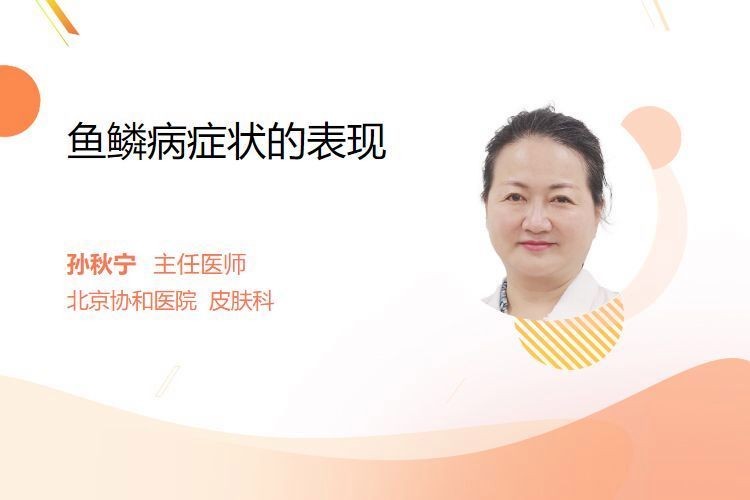 人類魚鱗病有哪些類型？：人類魚鱗病有哪些類型