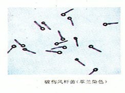 如何預(yù)防龍魚咬傷感染？|龍魚咬了出血了怎么辦黃耿文主任醫(yī)師三甲被咬出血了怎么辦