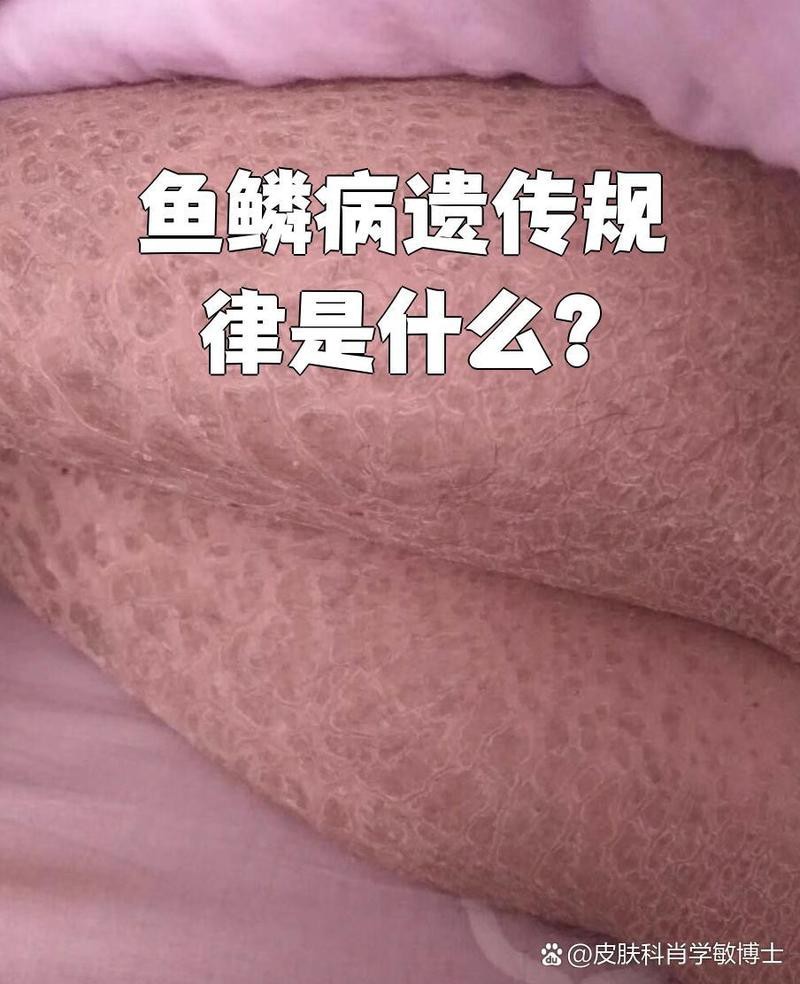 過背金龍珠鱗變異會遺傳嗎？【過背金龍珠鱗變異存在遺傳的可能性，但并非絕對】
