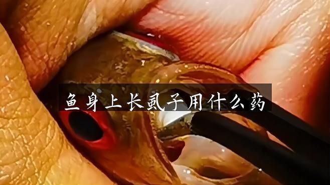 哪種方法治療魚虱最有效？【治療魚虱感染的最有效方法】